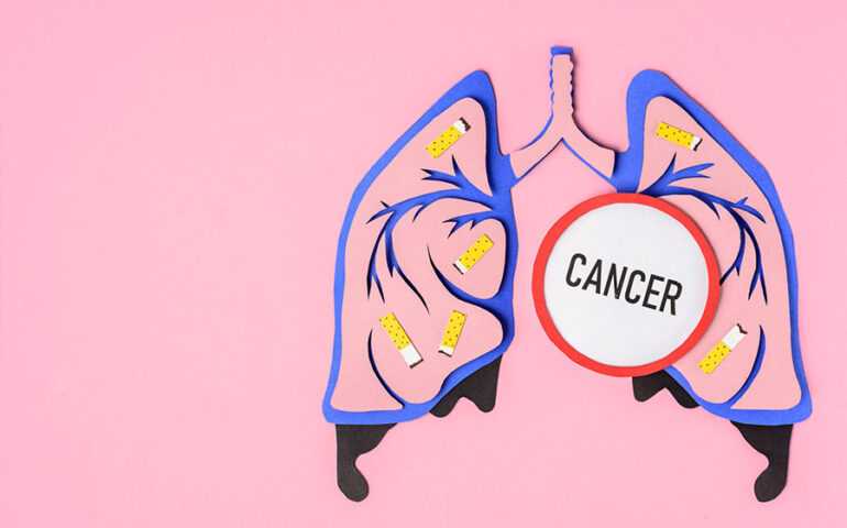 lung_cancer_MAIN_1